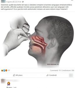 barriera sanguigna ematoencefalica